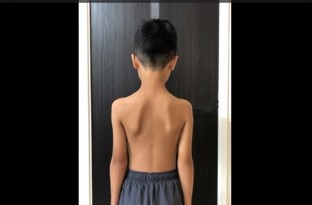 子供の肩甲骨